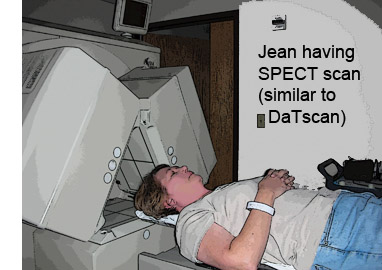 Jean in a spect scan - similar to DaTscan